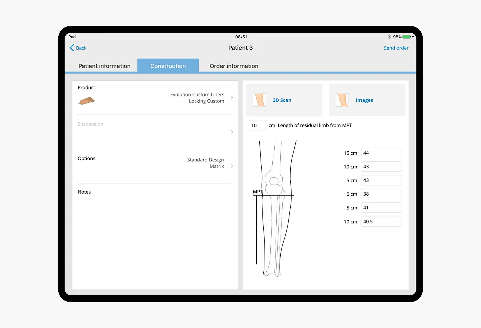 Össur-custom-prosthetic-ordering
